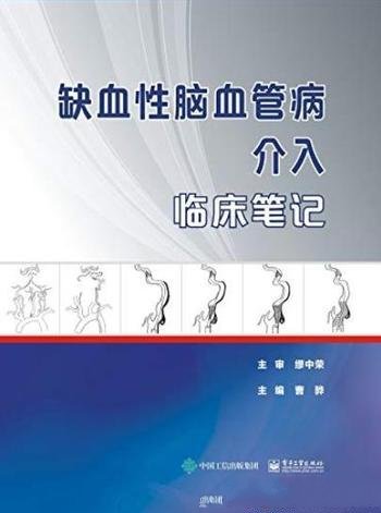 《缺血性脑血管病介入临床笔记》曹骅/189个病例